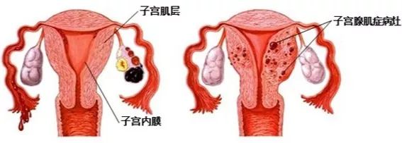 【七院名医】李田:痛经不要强忍着,排查原因很重要!