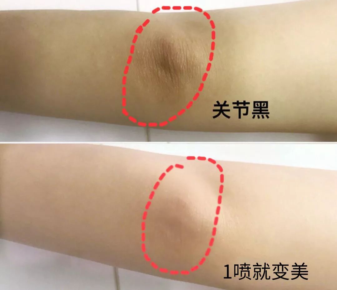 液体*袜丝**是什么鬼？用过的妹子都尖叫！黑腿瑕疵都没了