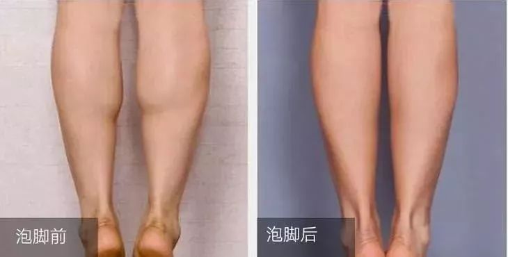 秋冬泡脚加点它,天冷了用这种方法泡脚更有益健康