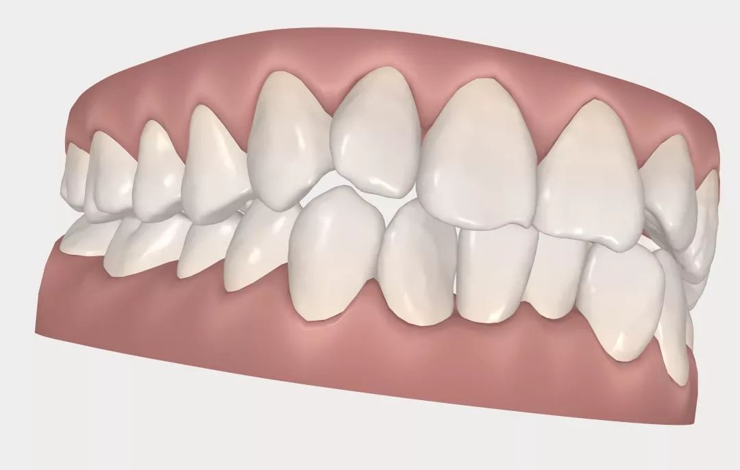 怀孕可以做乳房矫正吗,30岁哺乳期矫正牙齿的利与弊