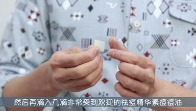 要你好看|听过很多祛痘方法,却还是收拾不了“车祸脸”?