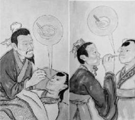 古代天花病毒怎么消灭的,古代天花接种是怎么接种的