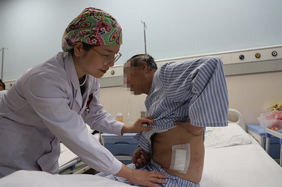 河南首例新技术治愈中风神经痛