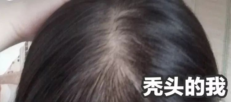 蓬松神器让头发立马蓬松,头发蓬松神器顶发根