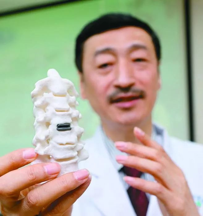 全球首例3d打印人工椎间盘置换术,世界首例3d打印距骨移植手术