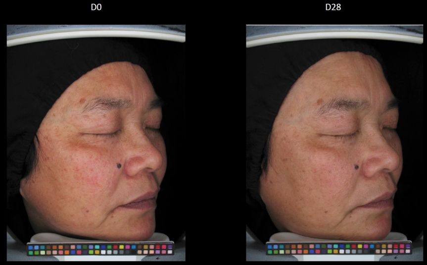 疯狂美白,这四种美白方法千万别乱试