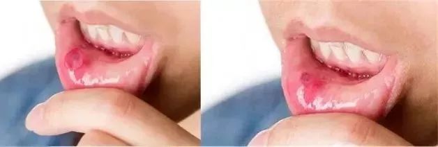 团购|俄罗斯亮白牙膏组合，轻松瓦解多年牙垢，清新口气告别黄牙