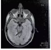 农场里走出CT鼻祖，美苏核危机诞生磁共振！