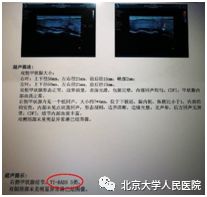 甲状腺病知识宣传周,甲状腺知识宣传周文章