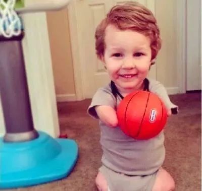 她地震中失去双腿,她在汶川地震失去双腿及女儿