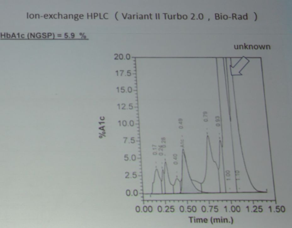糖化血红蛋白测定会有误差吗,糖化血红蛋白分析误差大吗