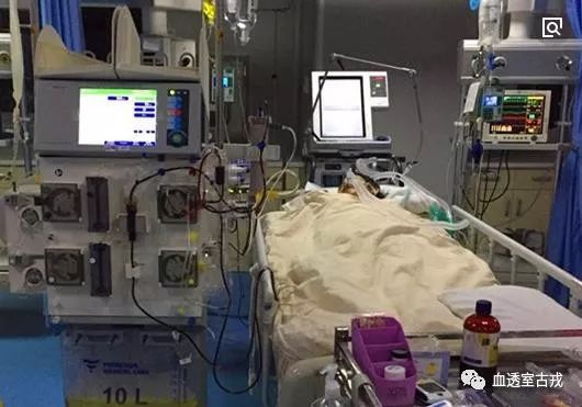 crrt治疗的常用模式,crrt治疗原理讲解