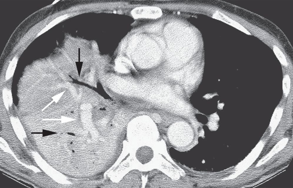 认识肺部的目的,认识呼吸器官知识点