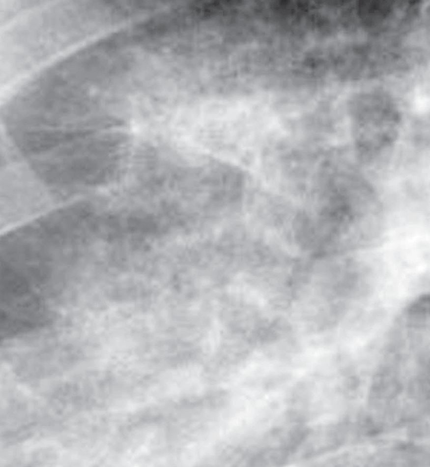 认识肺部的目的,认识呼吸器官知识点