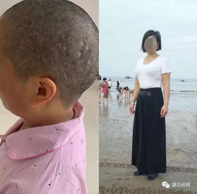 女子用了这种染发剂口吐白沫,两次进急诊!卖家说....