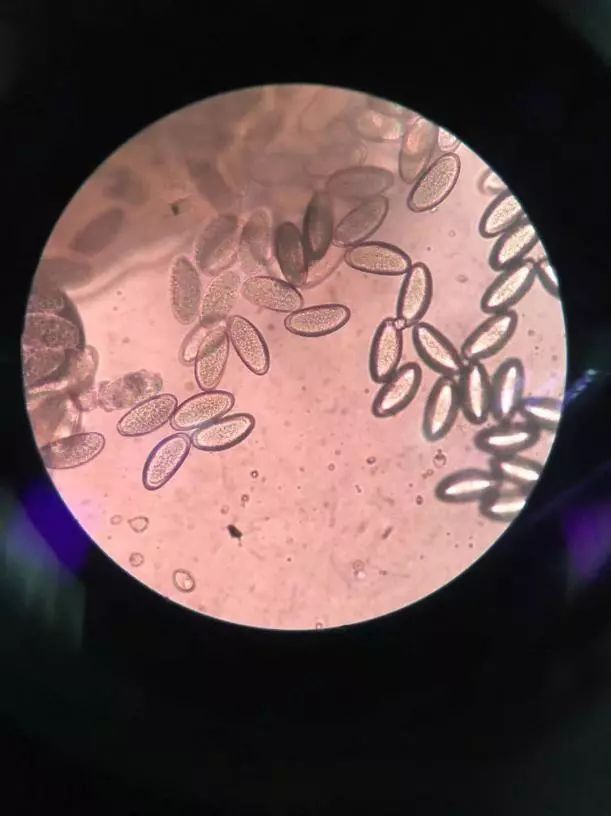 四岁女宝宝说小便地方痒和痛,四岁女宝宝总说小便处痒