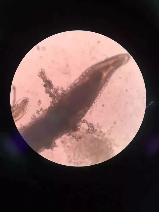 宝宝屁股痒怎么才能止痒,宝宝屁股痒痒怎么止痒