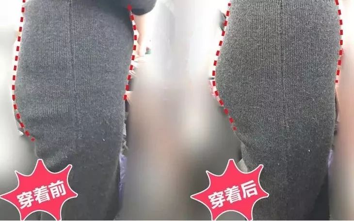 女生不注意下身卫生的危害,外阴寄生虫感染