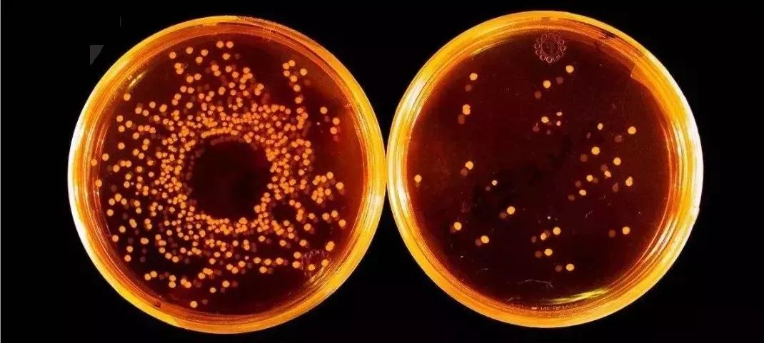 洗衣机里加上它陈年污垢全出来了,洗衣机污垢和霉菌危害