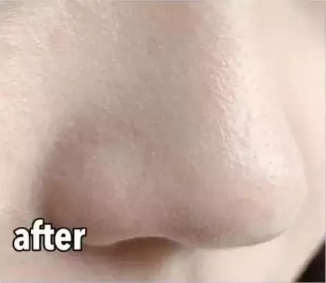 10块钱以内的护肤品都有什么,10块钱护肤好东西