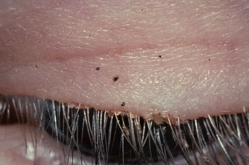 一些吸血的昆虫蜱虫,好多小虫子吸血