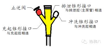 尿管只是导尿的吗？丨朝花夕拾·协和八