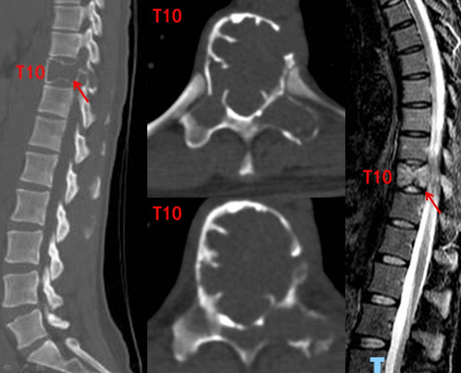 筋骨堂筋膜刀,筋骨堂整脊