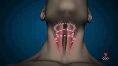 打呼噜其实是一种病,打呼噜是一种病吗有药可治吗