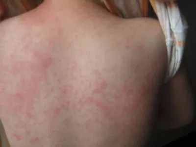 洗衣机里加上它陈年污垢全出来了,洗衣机污垢和霉菌危害