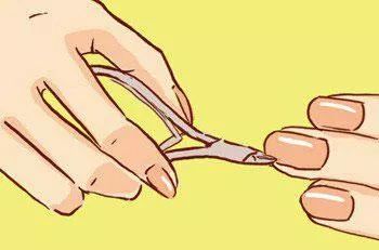 血泪教训的十个方法,手上长倒刺别乱撕这样做更靠谱