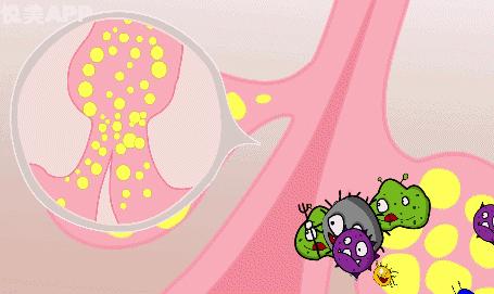 痘痘一直不好怎么办,女生脸上痘痘一直不好