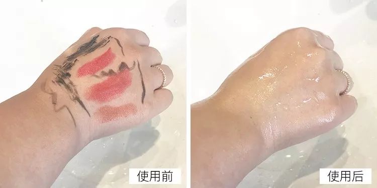 20分钟清理背部螨虫痘痘,十秒去除螨虫