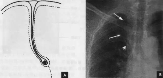 小学学霸学习方法大揭秘,小学学霸学习时间表