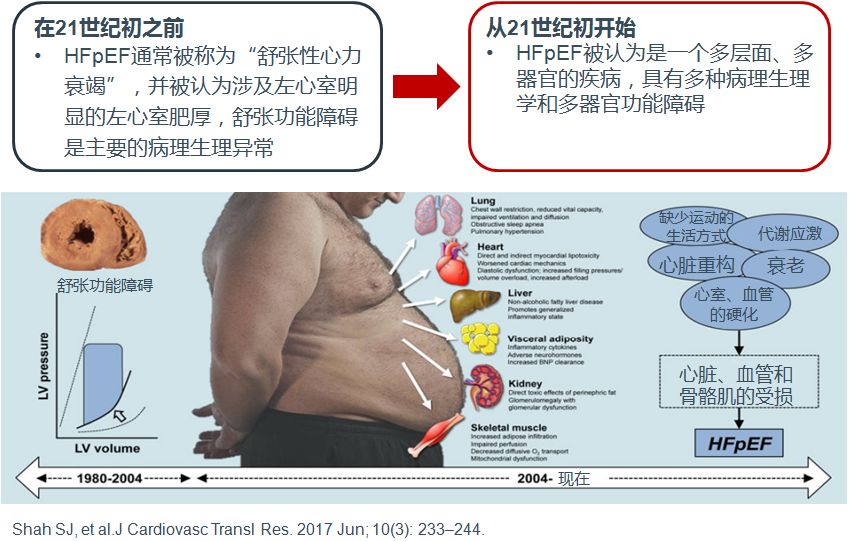 「2019CIHFC」高传玉教授：HFpEF诊断治疗新进展