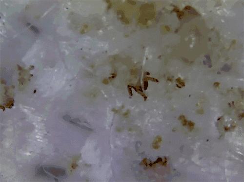 头皮发痒爱出油是什么引起的,头皮出油严重痒是什么原因引起的