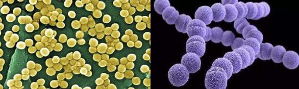 「健康」长脓疱、流黄水…最近这种病高发，不少孩子已中招