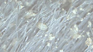 除螨虫喷雾剂哪款最好,喷一喷就可以除螨是真的吗