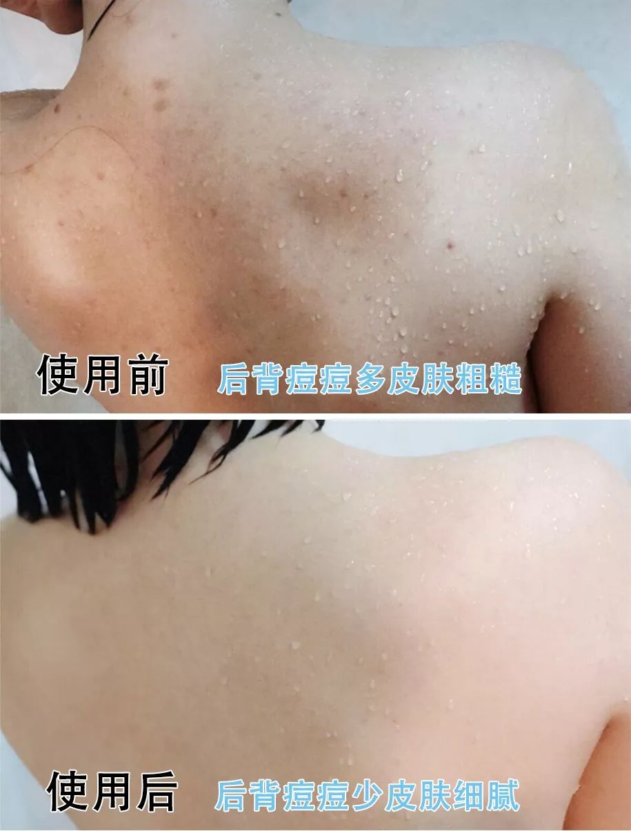 搓背长条沐浴刷,懒人浴室搓背刷