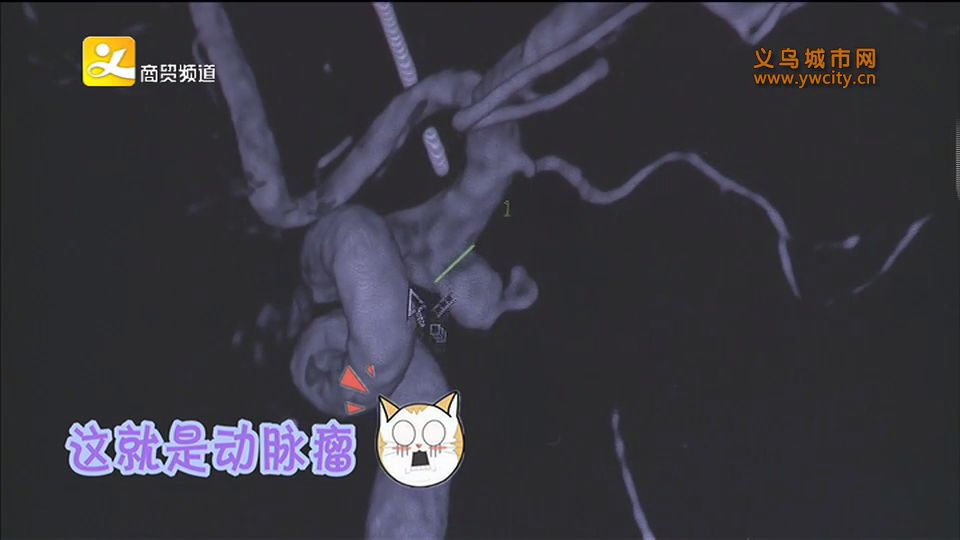 脑子泡在血水里！这种“不定时*弹炸**”很多人都有