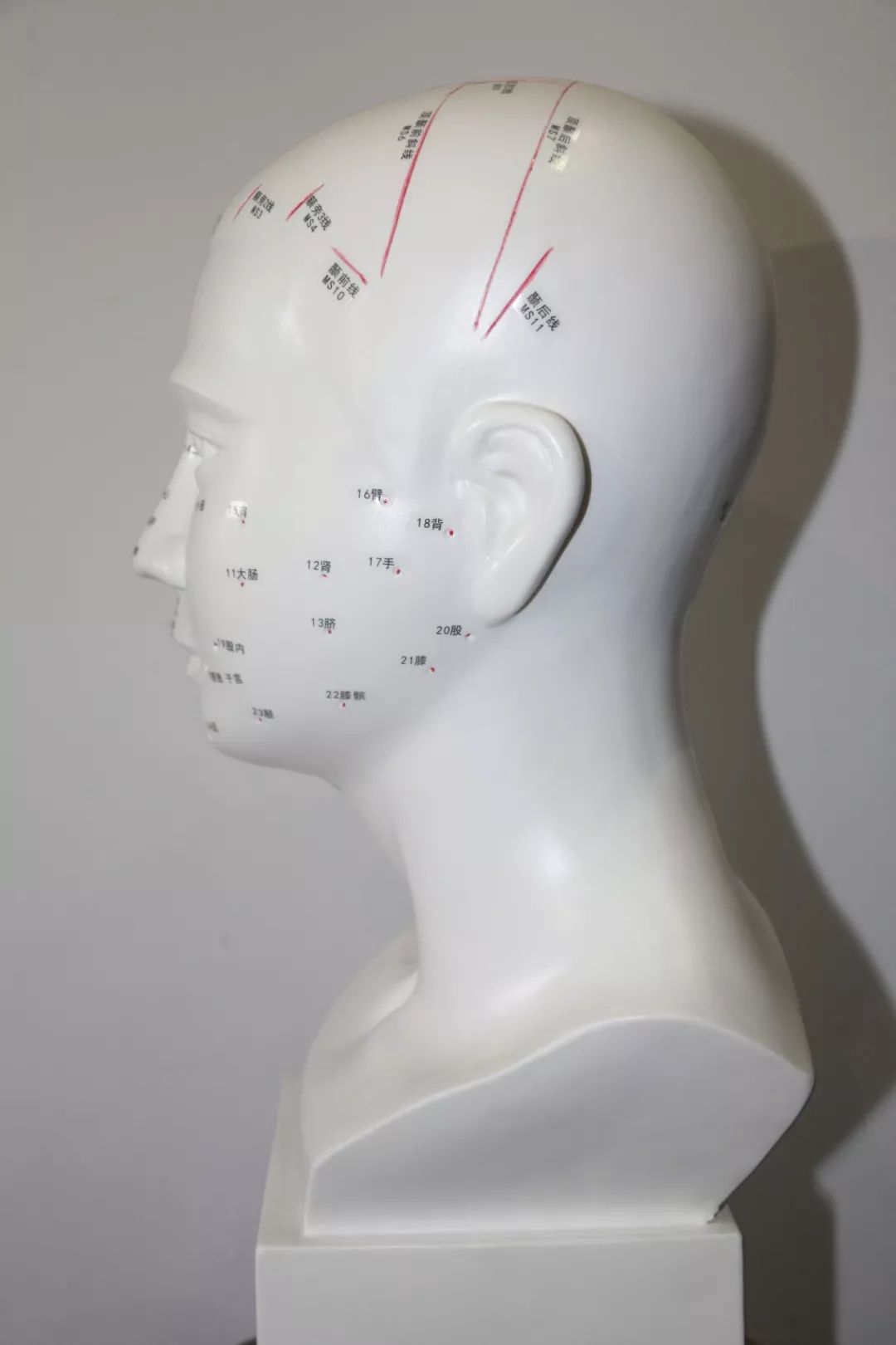 眉毛脱落是身体发出的警告,眉毛脱落是什么病原因引起的