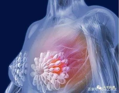 【永平科普】［卫生健康篇］日常生活中如何预防乳腺癌？如何早期发现乳腺癌？