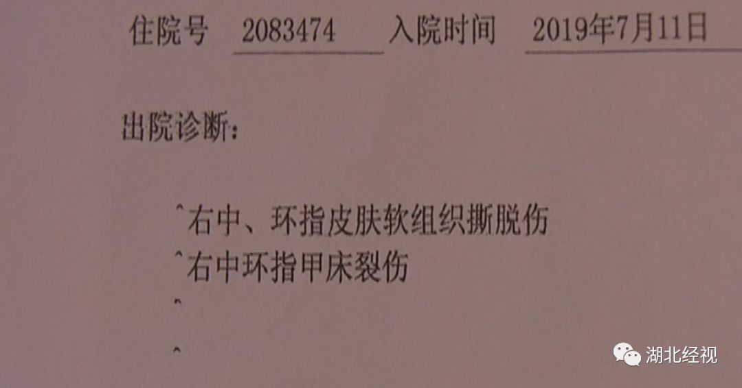 培训课堂上桌子倾倒，5岁女孩2根手指受伤！指腹坏死，后期还需要多次手术