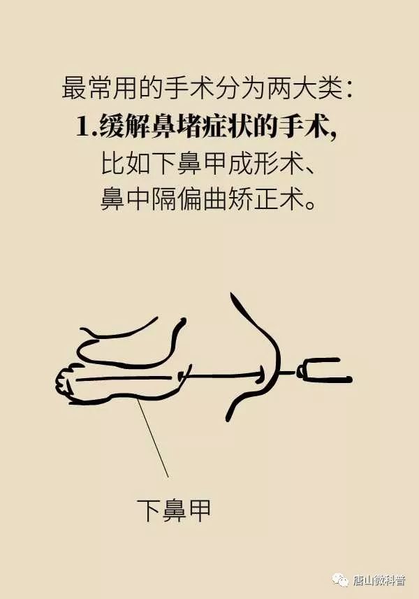 如何与过敏性鼻炎斗智斗勇,过敏性鼻炎及时制止