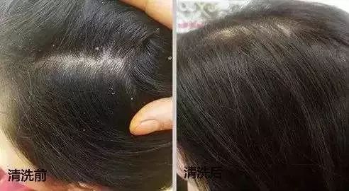 真正好用的洗发神器,一款超级好用的洗头神器