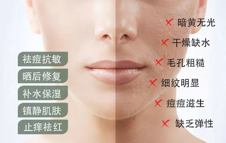 芦荟胶补水保湿提亮肤色晒后修复,万能芦荟胶补水美白修复敏感肌