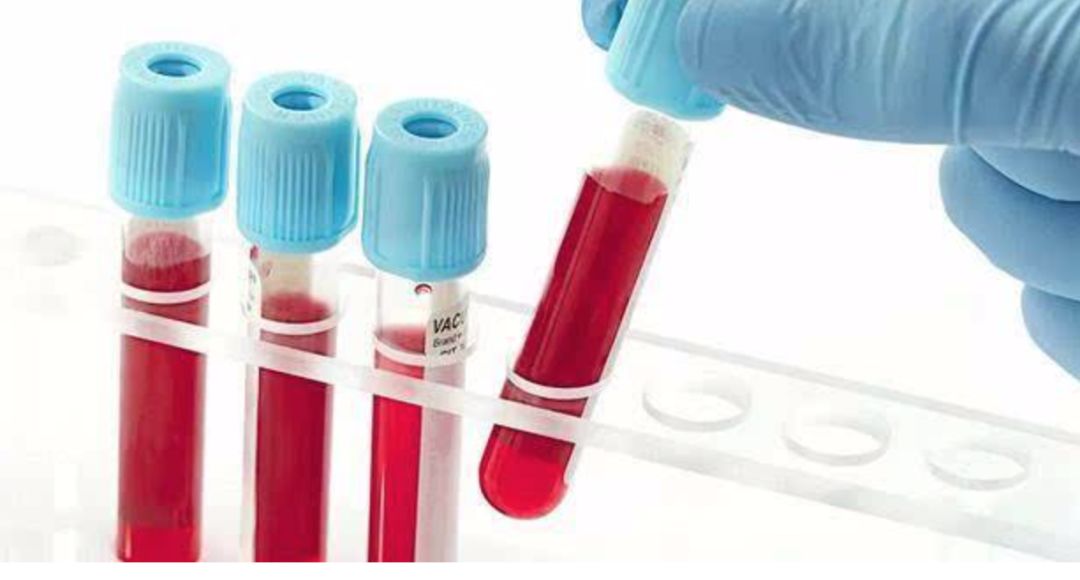 不是癌症的恶性肿瘤有哪些,不是癌症的绝症有哪些