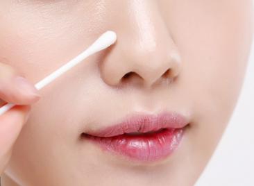 脸上长了脂肪粒用什么方法能去除,脸上长脂肪粒3个小妙招去除