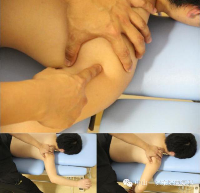 筋膜的康复训练方法,12条筋膜链解析及治疗手法