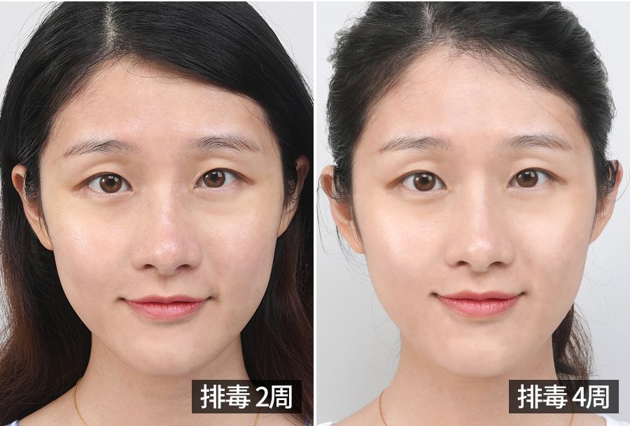 宋慧乔金喜善大长今,大长今金喜善宋慧乔