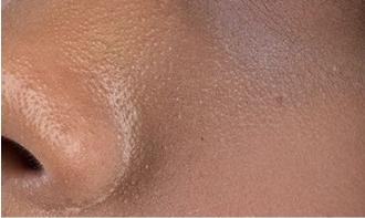 脸上搓出3斤泥!难怪又黄又暗又黑头!10秒给脸蛋“剥壳”,厉害